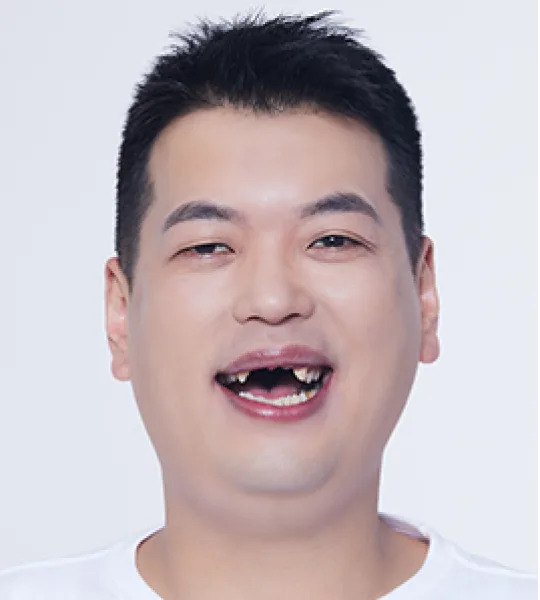 박홍일