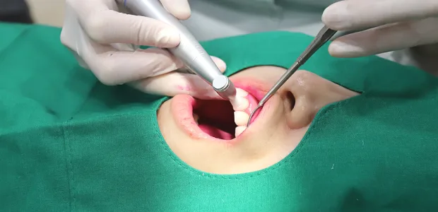 플란 플러스케어 3