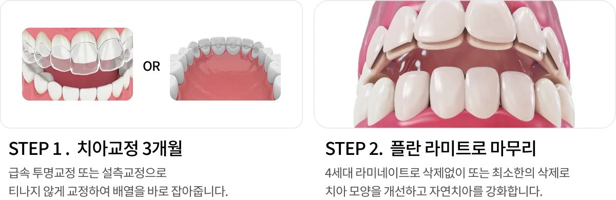 치료 과정 1단계