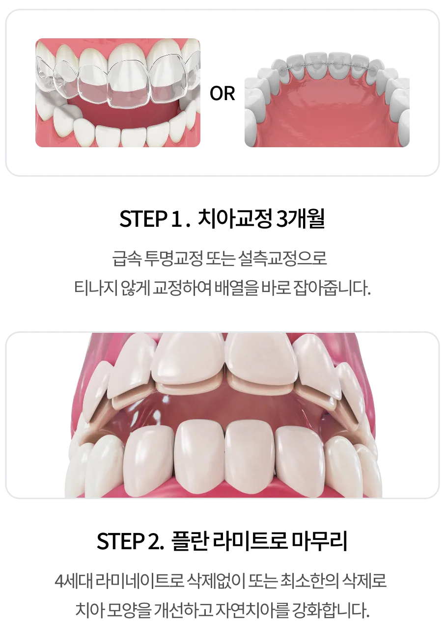 치료 과정 1단계 모바일